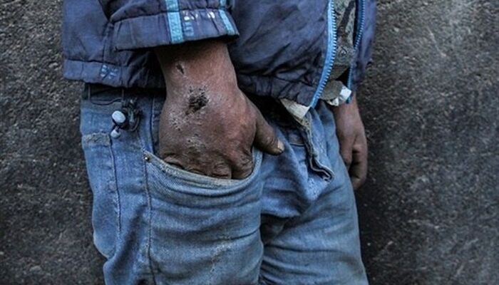 قارچ مقدس و ملوان زبل؛مخدرهای جدیدی که جوانان را گرفتار توهم می‌کنند!